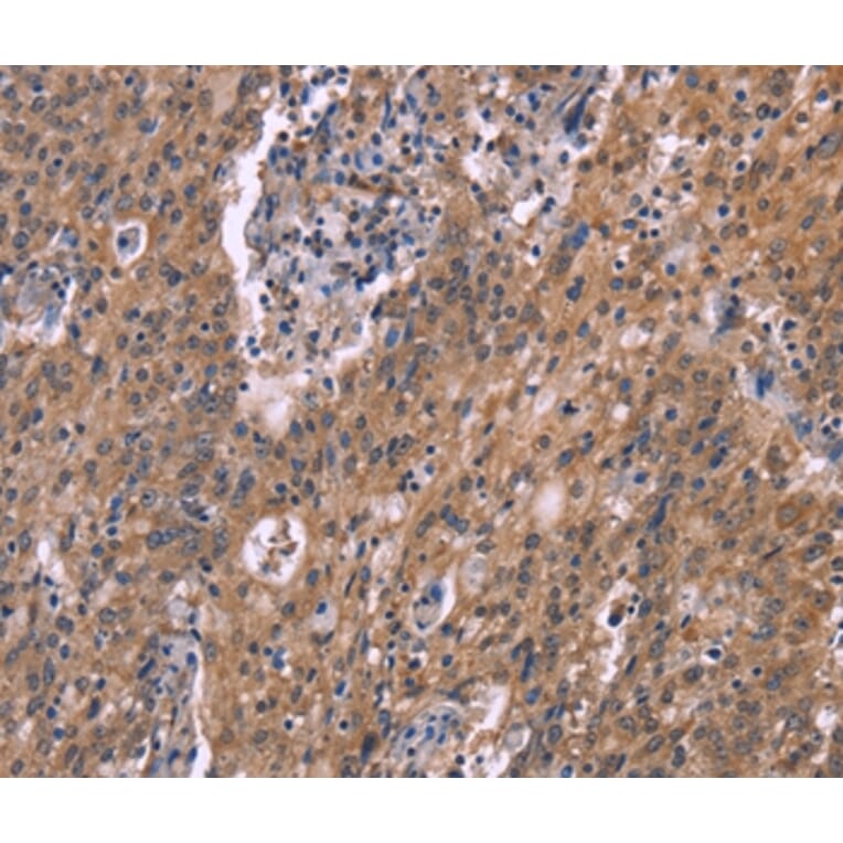 Immunohistochemistry - HSD11B2 Antibody from Signalway Antibody (37634) - Antibodies.com