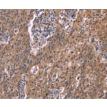 Immunohistochemistry - HSD11B2 Antibody from Signalway Antibody (37634) - Antibodies.com