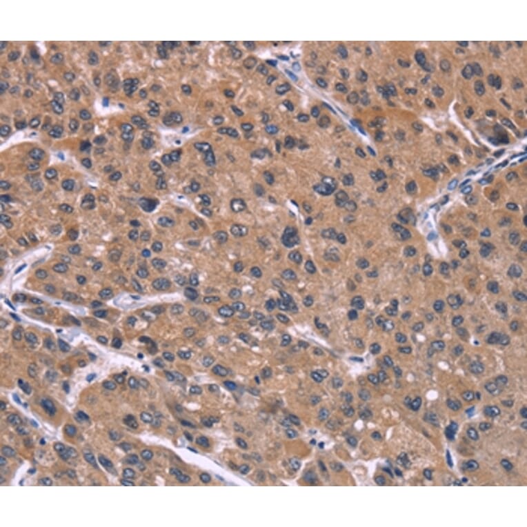 Immunohistochemistry - HSD11B2 Antibody from Signalway Antibody (37634) - Antibodies.com