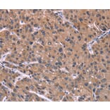 Immunohistochemistry - HSD11B2 Antibody from Signalway Antibody (37634) - Antibodies.com