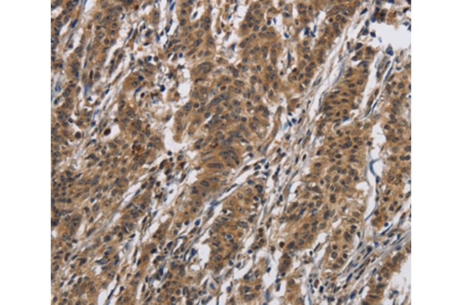 Immunohistochemistry - IL12RB2 Antibody from Signalway Antibody (37645) - Antibodies.com