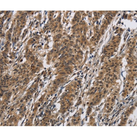 Immunohistochemistry - IL12RB2 Antibody from Signalway Antibody (37645) - Antibodies.com