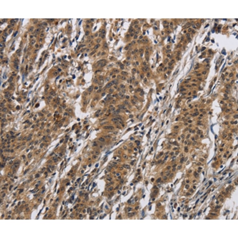 Immunohistochemistry - IL12RB2 Antibody from Signalway Antibody (37645) - Antibodies.com