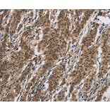 Immunohistochemistry - IL12RB2 Antibody from Signalway Antibody (37645) - Antibodies.com