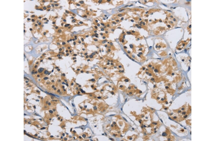 Immunohistochemistry - IL12RB2 Antibody from Signalway Antibody (37645) - Antibodies.com