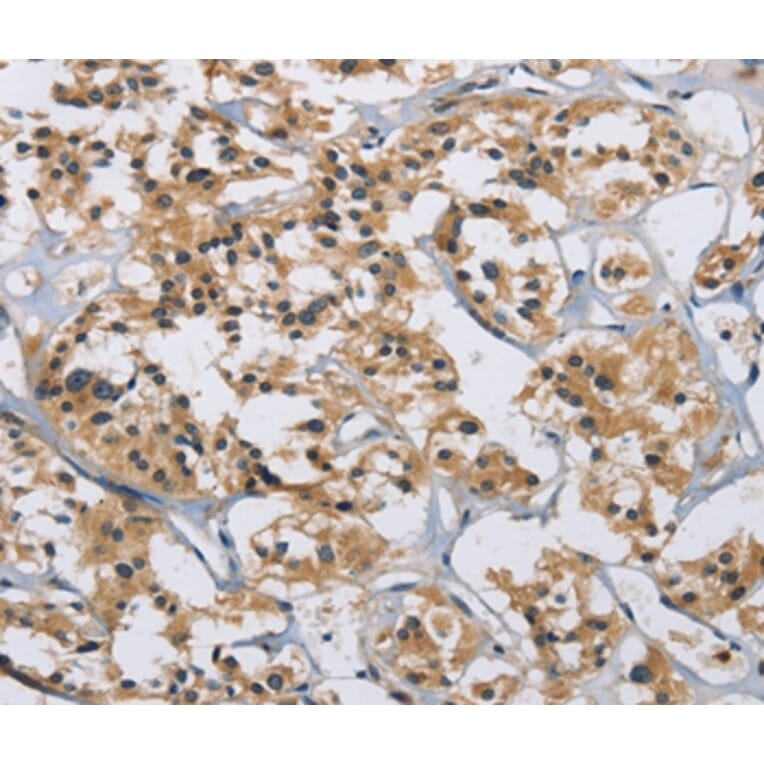 Immunohistochemistry - IL12RB2 Antibody from Signalway Antibody (37645) - Antibodies.com