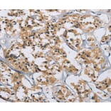 Immunohistochemistry - IL12RB2 Antibody from Signalway Antibody (37645) - Antibodies.com