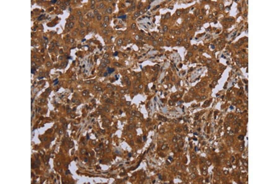 Immunohistochemistry - SCGB1D2 Antibody from Signalway Antibody (37704) - Antibodies.com