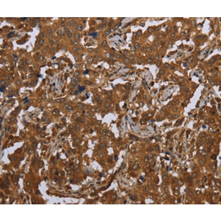 Immunohistochemistry - SCGB1D2 Antibody from Signalway Antibody (37704) - Antibodies.com