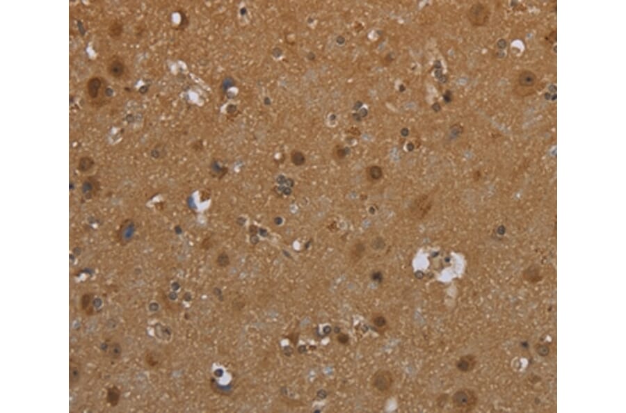 Immunohistochemistry - SCGB1D2 Antibody from Signalway Antibody (37704) - Antibodies.com