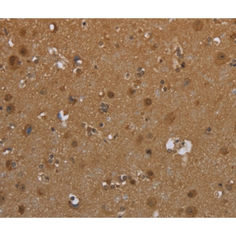 Immunohistochemistry - SCGB1D2 Antibody from Signalway Antibody (37704) - Antibodies.com