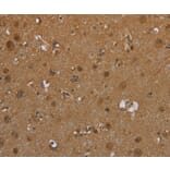 Immunohistochemistry - SCGB1D2 Antibody from Signalway Antibody (37704) - Antibodies.com