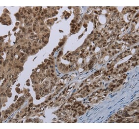 Immunohistochemistry - MAGEB18 Antibody from Signalway Antibody (37708) - Antibodies.com