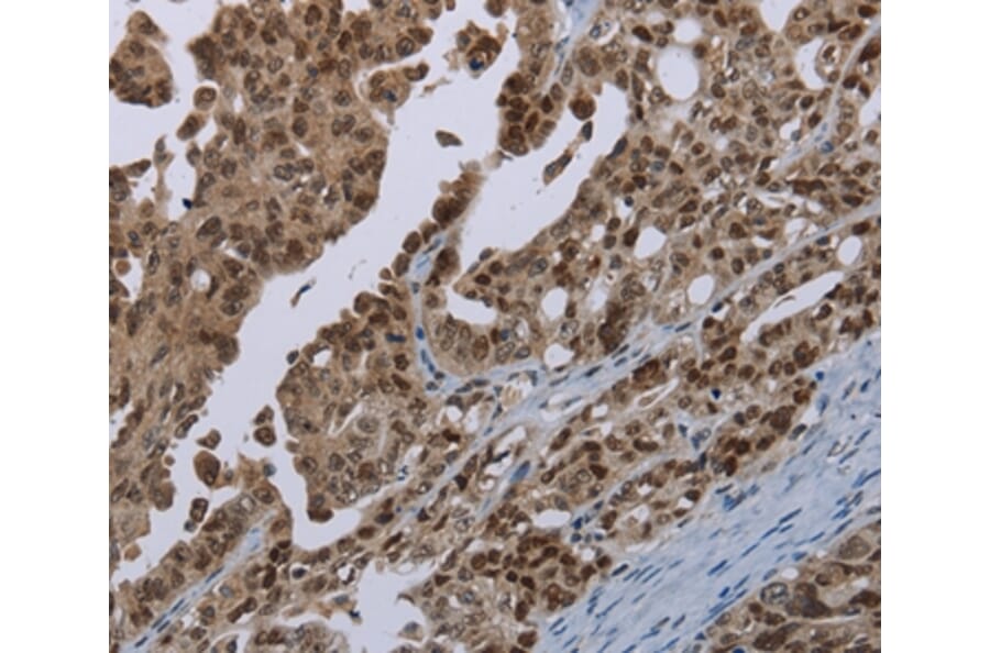 Immunohistochemistry - MAGEB18 Antibody from Signalway Antibody (37708) - Antibodies.com