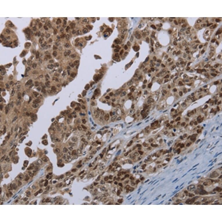 Immunohistochemistry - MAGEB18 Antibody from Signalway Antibody (37708) - Antibodies.com