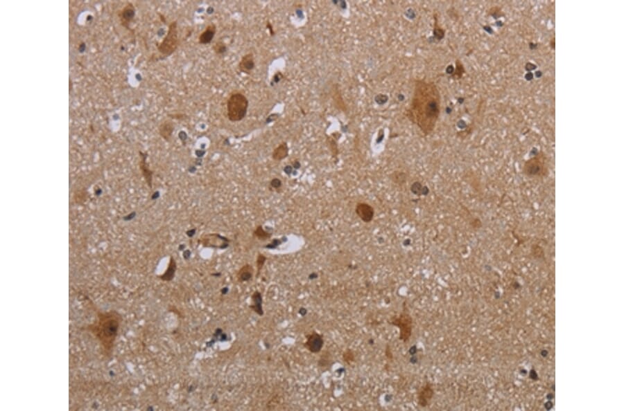Immunohistochemistry - MAGEB18 Antibody from Signalway Antibody (37708) - Antibodies.com