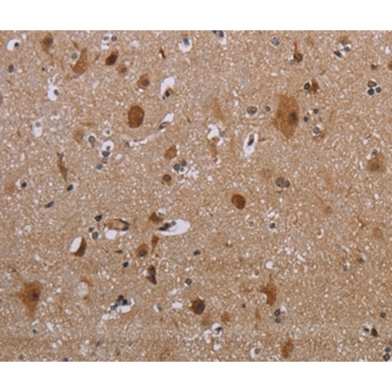 Immunohistochemistry - MAGEB18 Antibody from Signalway Antibody (37708) - Antibodies.com