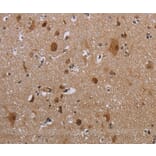 Immunohistochemistry - MAGEB18 Antibody from Signalway Antibody (37708) - Antibodies.com