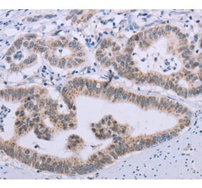 Immunohistochemistry - MRGPRX1 Antibody from Signalway Antibody (37739) - Antibodies.com