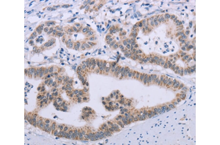 Immunohistochemistry - MRGPRX1 Antibody from Signalway Antibody (37739) - Antibodies.com