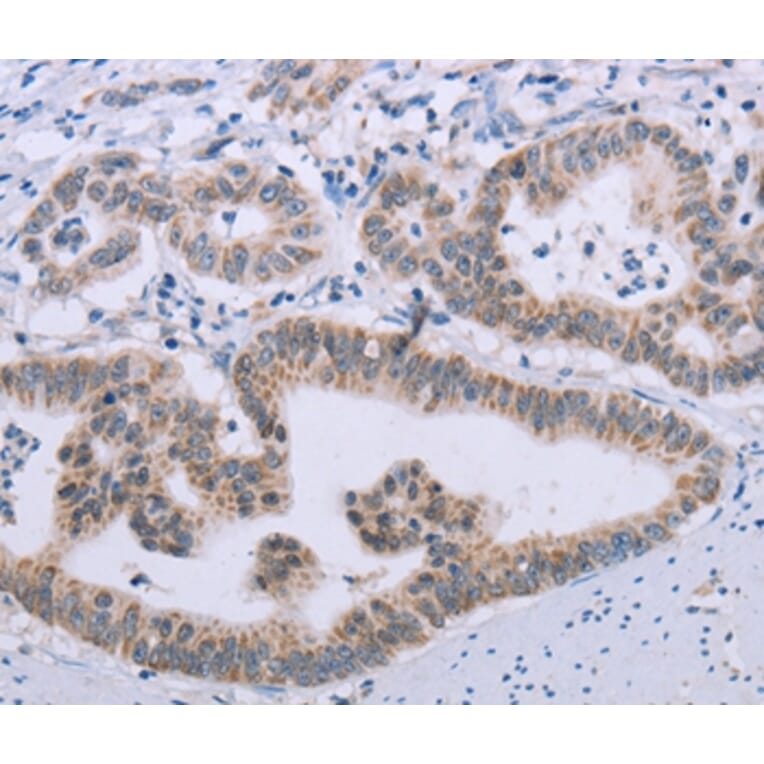 Immunohistochemistry - MRGPRX1 Antibody from Signalway Antibody (37739) - Antibodies.com