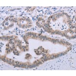 Immunohistochemistry - MRGPRX1 Antibody from Signalway Antibody (37739) - Antibodies.com