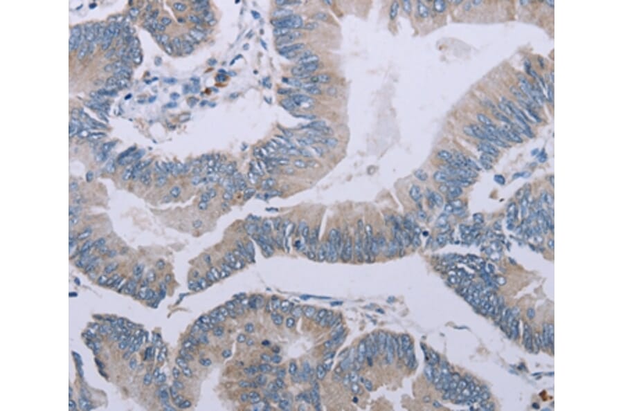 Immunohistochemistry - MRGPRX1 Antibody from Signalway Antibody (37739) - Antibodies.com