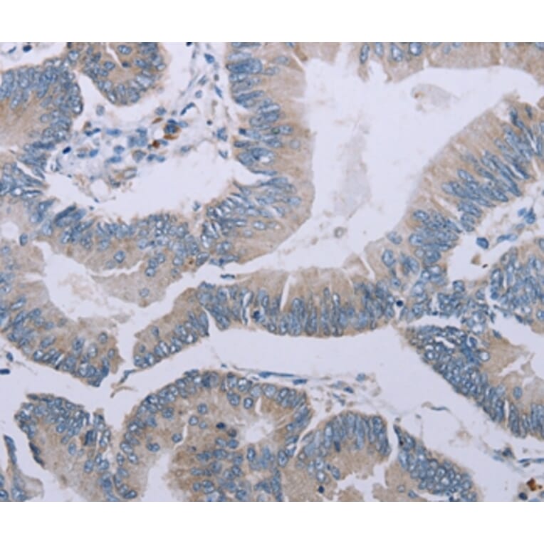 Immunohistochemistry - MRGPRX1 Antibody from Signalway Antibody (37739) - Antibodies.com