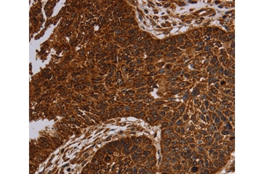 Immunohistochemistry - NDUFAB1 Antibody from Signalway Antibody (37755) - Antibodies.com