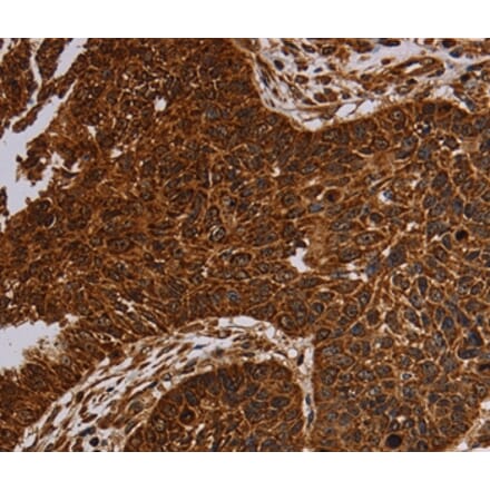 Immunohistochemistry - NDUFAB1 Antibody from Signalway Antibody (37755) - Antibodies.com