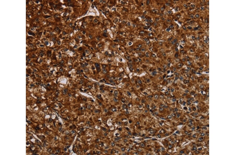 Immunohistochemistry - NDUFAB1 Antibody from Signalway Antibody (37755) - Antibodies.com