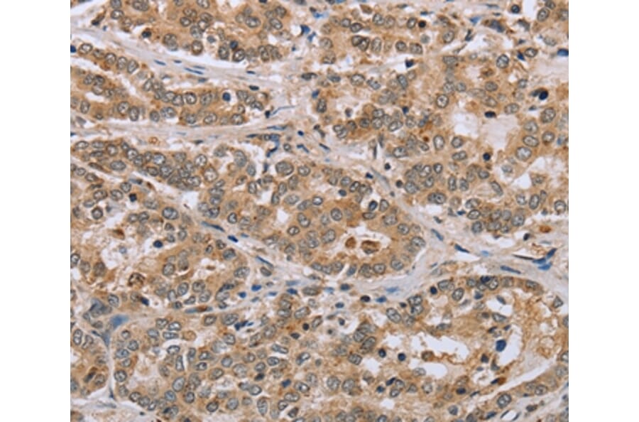 Immunohistochemistry - CLEC16A Antibody from Signalway Antibody (37766) - Antibodies.com