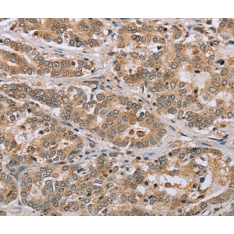 Immunohistochemistry - CLEC16A Antibody from Signalway Antibody (37766) - Antibodies.com