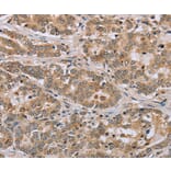 Immunohistochemistry - CLEC16A Antibody from Signalway Antibody (37766) - Antibodies.com