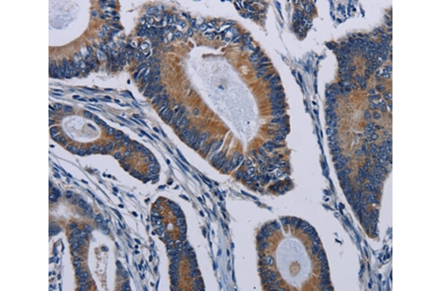 Immunohistochemistry - PCDHAC2 Antibody from Signalway Antibody (37803) - Antibodies.com