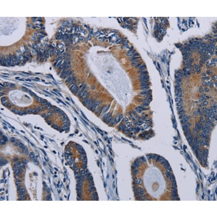 Immunohistochemistry - PCDHAC2 Antibody from Signalway Antibody (37803) - Antibodies.com