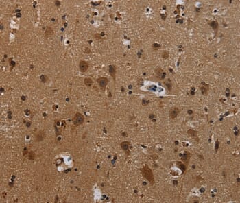 Immunohistochemical analysis of paraffin-embedded Human brain tissue using #37806 at dilution 1/50.