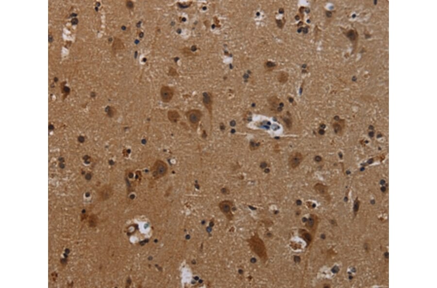 Immunohistochemistry - PCDHB11 Antibody from Signalway Antibody (37806) - Antibodies.com