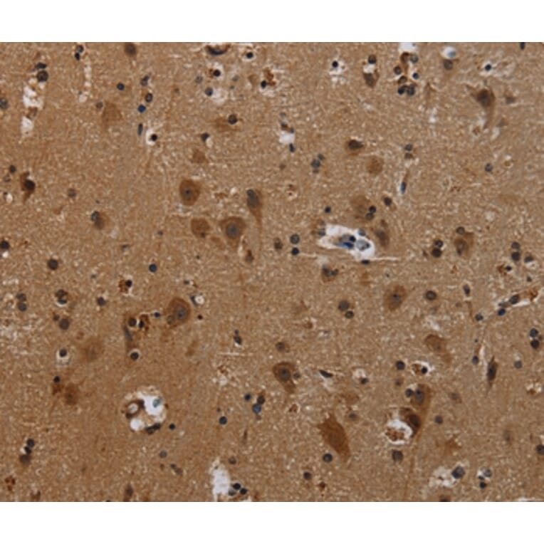 Immunohistochemistry - PCDHB11 Antibody from Signalway Antibody (37806) - Antibodies.com