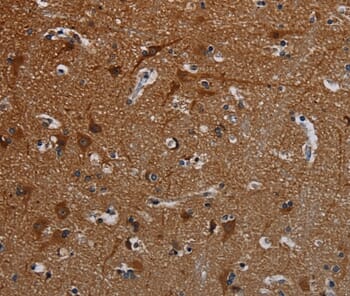 Immunohistochemical analysis of paraffin-embedded Human brain tissue using #37807 at dilution 1/50.