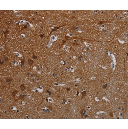 Immunohistochemistry - PCDHB15 Antibody from Signalway Antibody (37807) - Antibodies.com