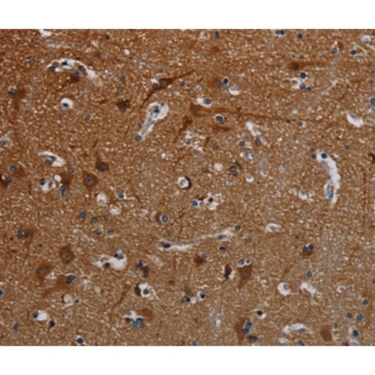 Immunohistochemistry - PCDHB15 Antibody from Signalway Antibody (37807) - Antibodies.com