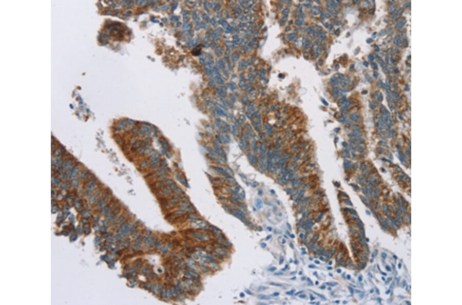 Immunohistochemistry - RPS6KA2 Antibody from Signalway Antibody (37882) - Antibodies.com