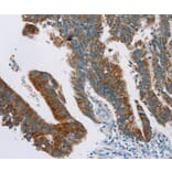 Immunohistochemistry - RPS6KA2 Antibody from Signalway Antibody (37882) - Antibodies.com