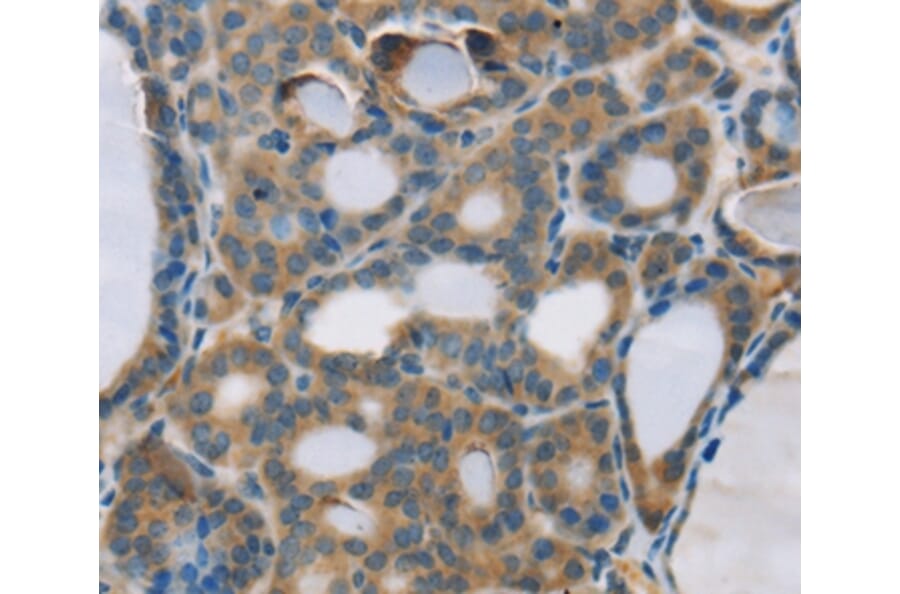 Immunohistochemistry - RPS6KA2 Antibody from Signalway Antibody (37882) - Antibodies.com