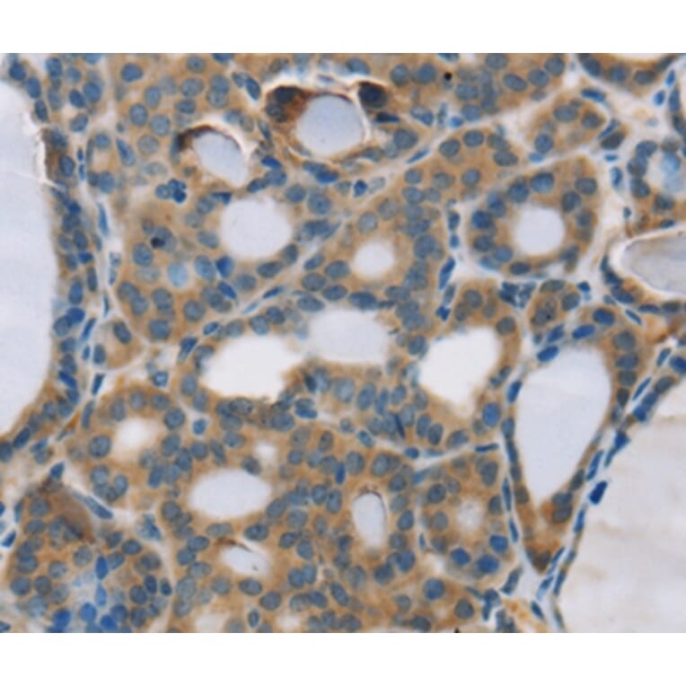 Immunohistochemistry - RPS6KA2 Antibody from Signalway Antibody (37882) - Antibodies.com