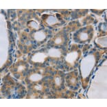 Immunohistochemistry - RPS6KA2 Antibody from Signalway Antibody (37882) - Antibodies.com