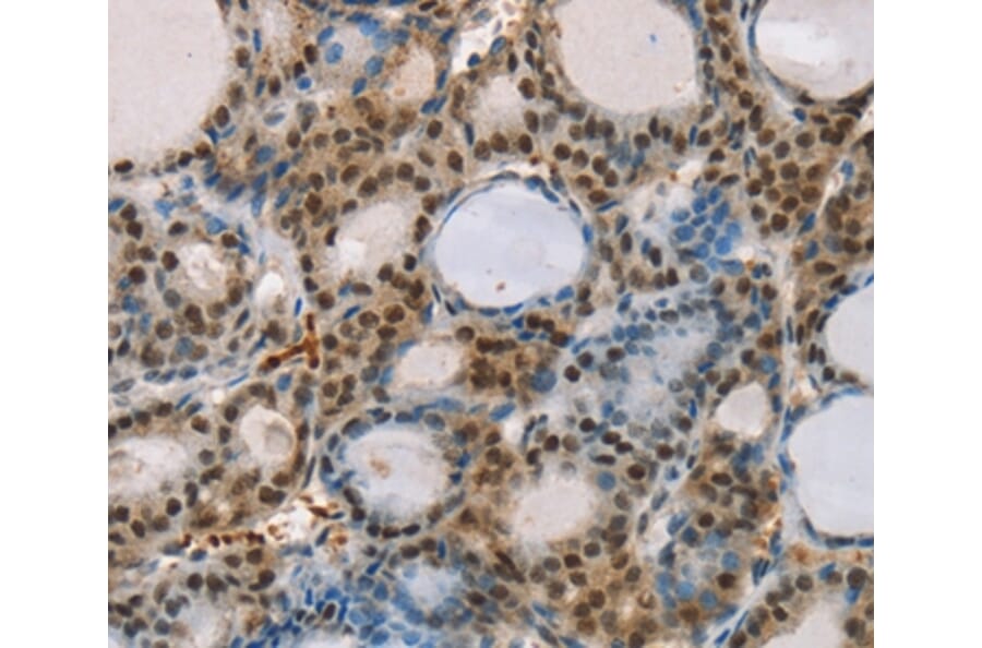 Immunohistochemistry - RUNX1T1 Antibody from Signalway Antibody (37883) - Antibodies.com