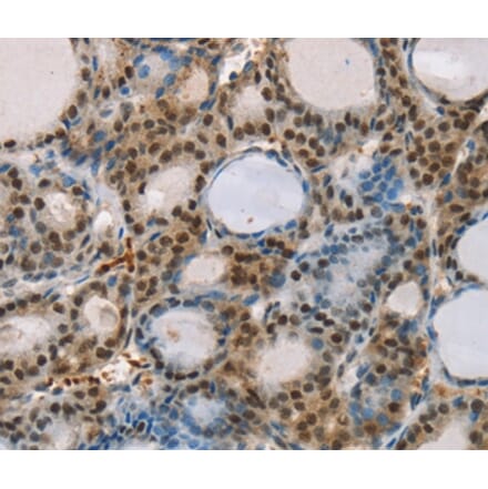 Immunohistochemistry - RUNX1T1 Antibody from Signalway Antibody (37883) - Antibodies.com
