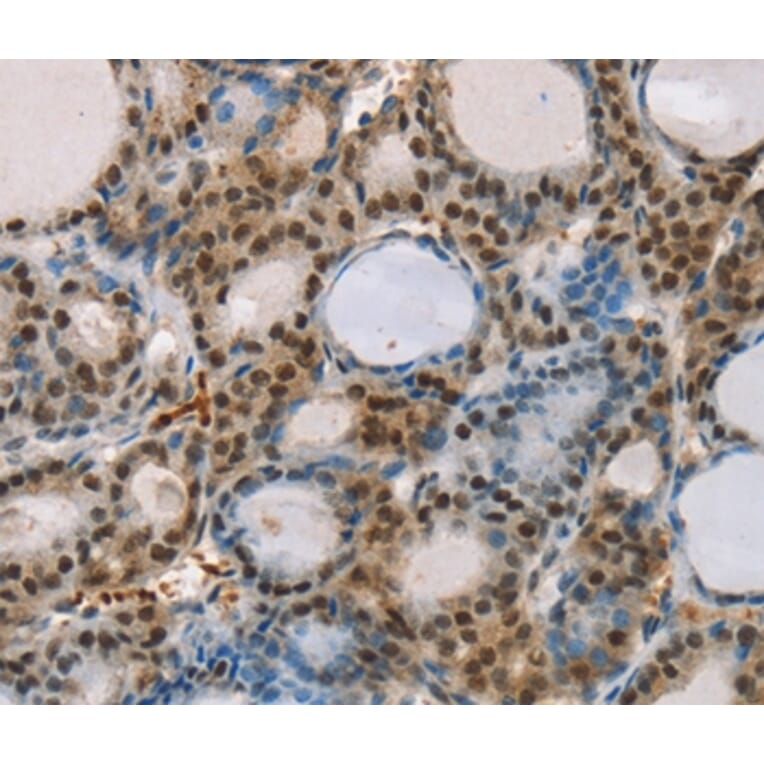 Immunohistochemistry - RUNX1T1 Antibody from Signalway Antibody (37883) - Antibodies.com